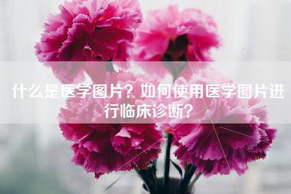什么是医学图片？如何使用医学图片进行临床诊断？